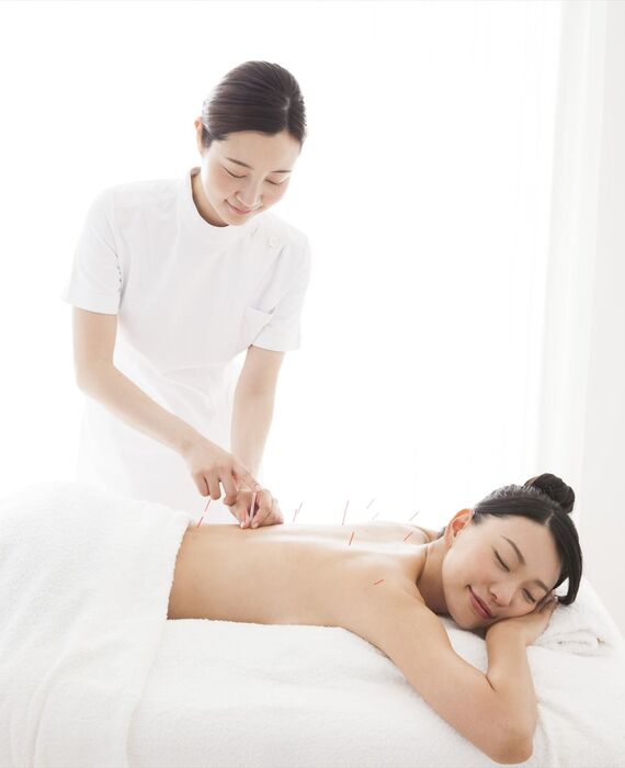 背中に鍼を打つ女性スタッフ